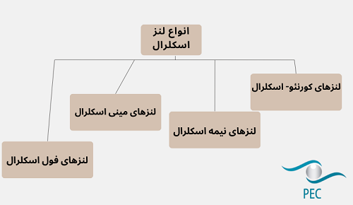 انواع لنز اسکلرال