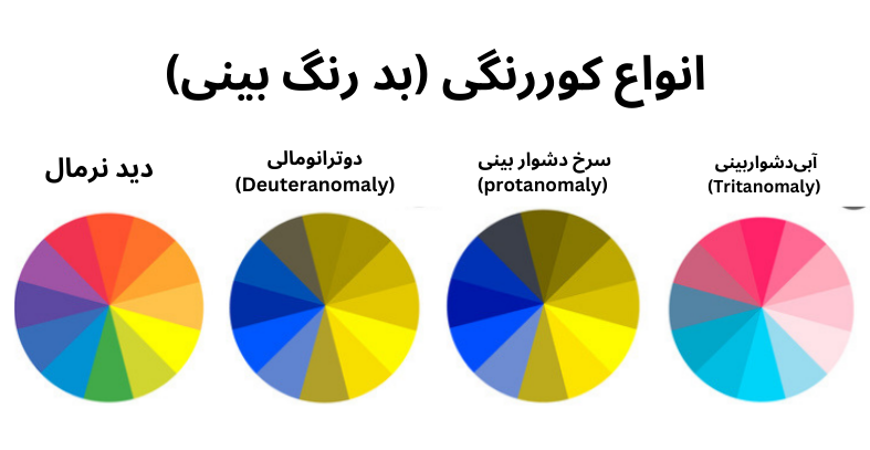 سه نوع اصلی کوررنگی